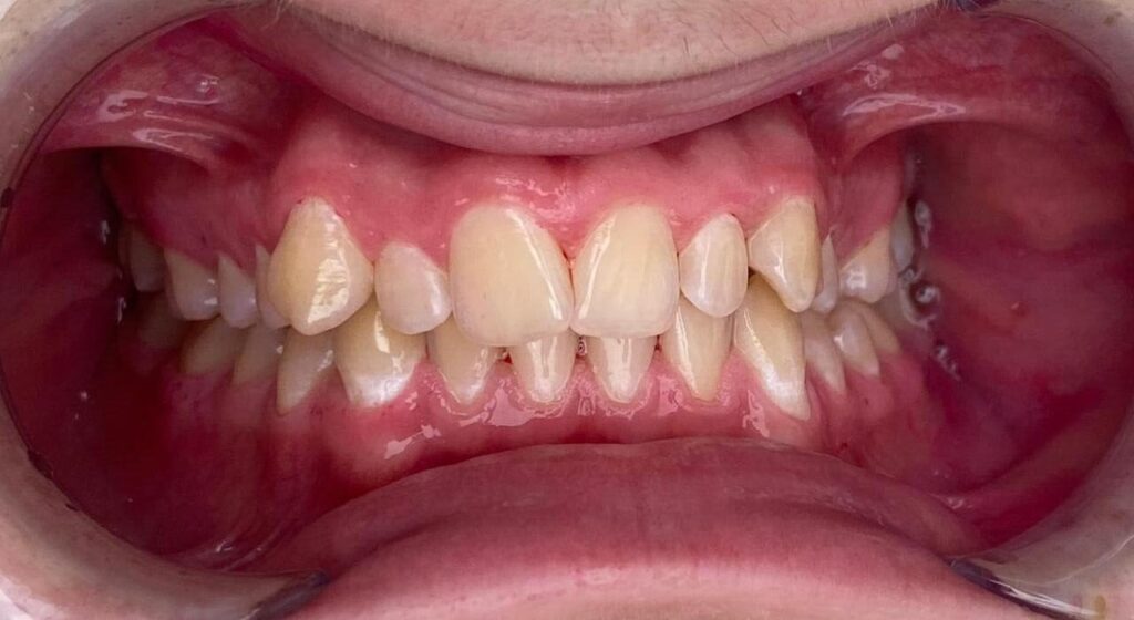 Smart Clean - după curațare